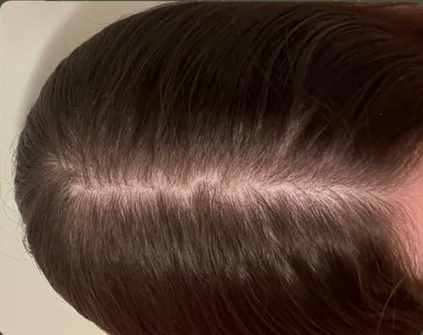 Mulher, 22 anos, depois do tratamento capilar